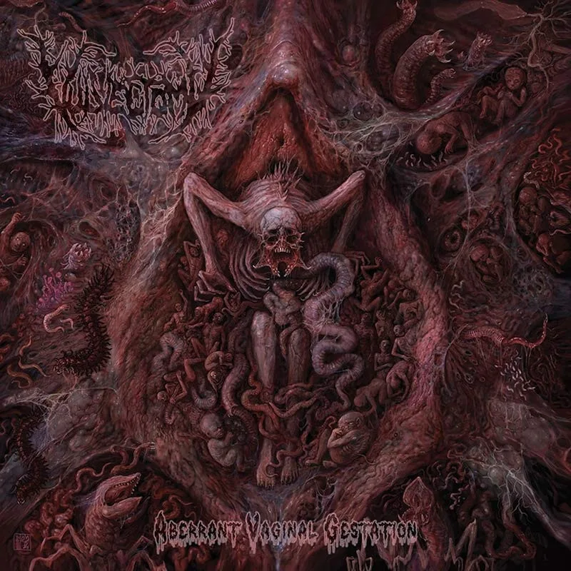 VULVECTOMY regresa con el brutal Aberrant Vaginal Gestation,